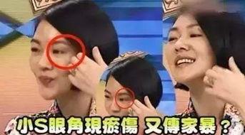 成源家暴爆料视频最新,真相揭露，受害者勇敢发声